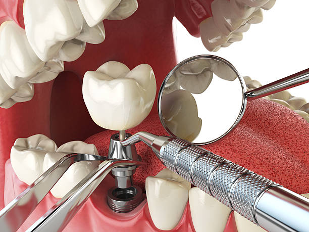 Best Emergency Dentist for Knocked-Out Tooth in Lamesa, TX